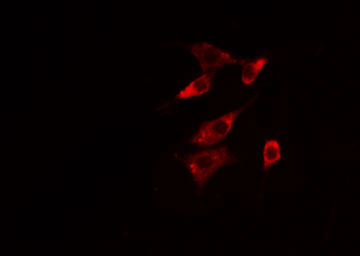 NTSR1 / NTR Antibody - Staining HeLa cells by IF/ICC. The samples were fixed with PFA and permeabilized in 0.1% Triton X-100, then blocked in 10% serum for 45 min at 25°C. The primary antibody was diluted at 1:200 and incubated with the sample for 1 hour at 37°C. An Alexa Fluor 594 conjugated goat anti-rabbit IgG (H+L) antibody, diluted at 1/600, was used as secondary antibody.
