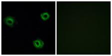 NTSR2 / NTR2 Antibody - Immunofluorescence analysis of A549 cells, using NTR2 Antibody. The picture on the right is blocked with the synthesized peptide.