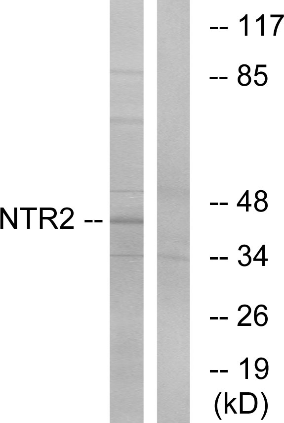 NTSR2 / NTR2 Antibody - Western blot analysis of lysates from Jurkat cells, using NTR2 Antibody. The lane on the right is blocked with the synthesized peptide.