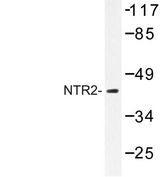 NTSR2 / NTR2 Antibody - Western blot of NTR2 (D184) pAb in extracts from Jurkat cells.