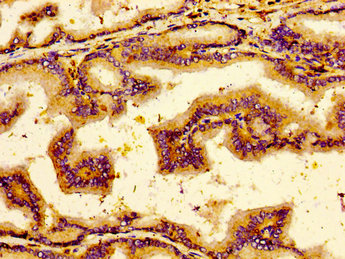 NTSR2 / NTR2 Antibody - Immunohistochemistry image of paraffin-embedded human prostate tissue at a dilution of 1:100