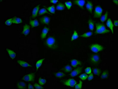 NTSR2 / NTR2 Antibody - Immunofluorescence staining of Hela cells with NTSR2 Antibody at 1:133, counter-stained with DAPI. The cells were fixed in 4% formaldehyde, permeabilized using 0.2% Triton X-100 and blocked in 10% normal Goat Serum. The cells were then incubated with the antibody overnight at 4°C. The secondary antibody was Alexa Fluor 488-congugated AffiniPure Goat Anti-Rabbit IgG(H+L).