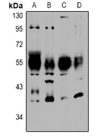 NTSR2 / NTR2 Antibody - Western blot analysis of NTR2 expression in U87MG (A), SGC7901 (B), C6 (C), NIH3T3L1 (D) whole cell lysates.