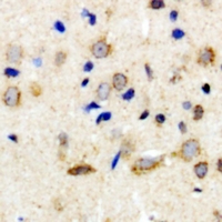 NTSR2 / NTR2 Antibody - Immunohistochemical analysis of NTR2 staining in human brain formalin fixed paraffin embedded tissue section. The section was pre-treated using heat mediated antigen retrieval with sodium citrate buffer (pH 6.0). The section was then incubated with the antibody at room temperature and detected using an HRP conjugated compact polymer system. DAB was used as the chromogen. The section was then counterstained with haematoxylin and mounted with DPX.