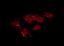 NTSR2 / NTR2 Antibody - Staining HeLa cells by IF/ICC. The samples were fixed with PFA and permeabilized in 0.1% Triton X-100, then blocked in 10% serum for 45 min at 25°C. The primary antibody was diluted at 1:200 and incubated with the sample for 1 hour at 37°C. An Alexa Fluor 594 conjugated goat anti-rabbit IgG (H+L) Ab, diluted at 1/600, was used as the secondary antibody.