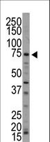 NUAK1 / ARK5 Antibody - Western blot of anti-ARK5 antibody in mouse brain tissue lysate. ARK5 (arrow) was detected using purified antibody. Secondary HRP-anti-rabbit was used for signal visualization with chemiluminescence.