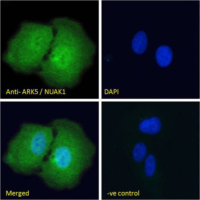 NUAK1 / ARK5 Antibody - Immunofluorescence analysis of paraformaldehyde fixed U2OS cells, permeabilized with 0.15% Triton. Primary incubation 1hr (10ug/ml) followed by Alexa Fluor 488 secondary antibody (2ug/ml), showing nuclear and cytoplasmic staining. The nuclear stai