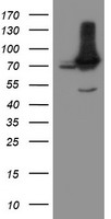 NUB1 Antibody - HEK293T cells were transfected with the pCMV6-ENTRY control (Left lane) or pCMV6-ENTRY NUB1 (Right lane) cDNA for 48 hrs and lysed. Equivalent amounts of cell lysates (5 ug per lane) were separated by SDS-PAGE and immunoblotted with anti-NUB1.