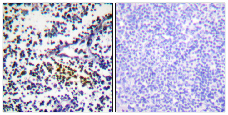 NUB1 Antibody - Immunohistochemistry analysis of paraffin-embedded human tonsil tissue, using NYREN18 Antibody. The picture on the right is blocked with the synthesized peptide.