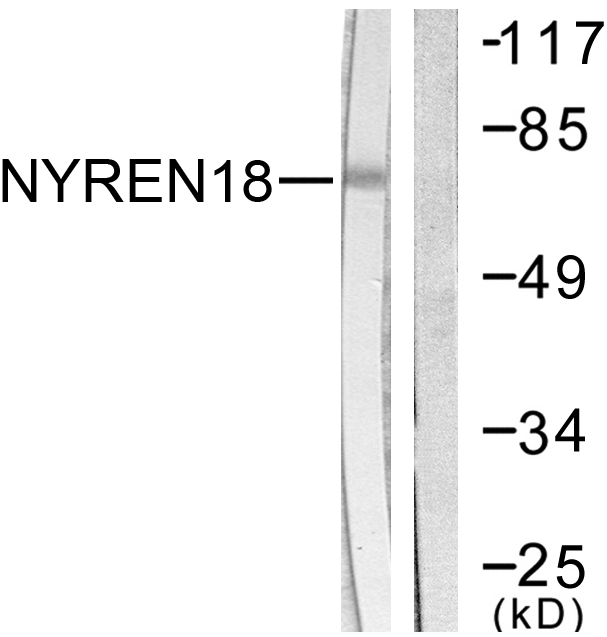 NUB1 Antibody - Western blot analysis of lysates from COS7 cells, using NYREN18 Antibody. The lane on the right is blocked with the synthesized peptide.