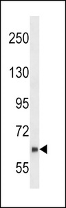 NUB1 Antibody - NYREN18 Antibody (E102) western blot of SK-BR-3 cell line lysates (35 ug/lane). The NYREN18 antibody detected the NYREN18 protein (arrow).