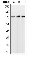 NUB1 Antibody - Western blot analysis of NUB1 expression in Jurkat (A); Raji (B); HepG2 (C) whole cell lysates.