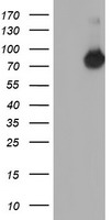 NUB1 Antibody - HEK293T cells were transfected with the pCMV6-ENTRY control (Left lane) or pCMV6-ENTRY NUB1 (Right lane) cDNA for 48 hrs and lysed. Equivalent amounts of cell lysates (5 ug per lane) were separated by SDS-PAGE and immunoblotted with anti-NUB1.