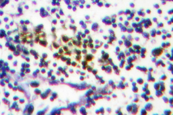 NUB1 Antibody - IHC of NYREN18 (Y601) pAb in paraffin-embedded human tonsil tissue.