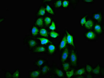 NUBP2 Antibody - Immunofluorescence staining of Hela cells with NUBP2 Antibody at 1:33, counter-stained with DAPI. The cells were fixed in 4% formaldehyde, permeabilized using 0.2% Triton X-100 and blocked in 10% normal Goat Serum. The cells were then incubated with the antibody overnight at 4°C. The secondary antibody was Alexa Fluor 488-congugated AffiniPure Goat Anti-Rabbit IgG(H+L).