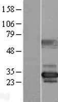 NUBP2 Protein - Western validation with an anti-DDK antibody * L: Control HEK293 lysate R: Over-expression lysate