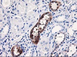 NUBPL Antibody - IHC of paraffin-embedded Human Kidney tissue using anti-NUBPL mouse monoclonal antibody. (Heat-induced epitope retrieval by 10mM citric buffer, pH6.0, 100C for 10min).