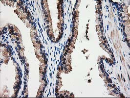 NUBPL Antibody - IHC of paraffin-embedded Human prostate tissue using anti-NUBPL mouse monoclonal antibody. (Heat-induced epitope retrieval by 10mM citric buffer, pH6.0, 100C for 10min).