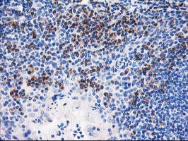 NUBPL Antibody - IHC of paraffin-embedded Human lymph node tissue using anti-NUBPL mouse monoclonal antibody. (Heat-induced epitope retrieval by 10mM citric buffer, pH6.0, 100C for 10min).