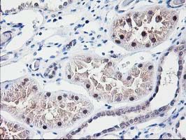 NUBPL Antibody - IHC of paraffin-embedded Human Kidney tissue using anti-NUBPL mouse monoclonal antibody. (Heat-induced epitope retrieval by 10mM citric buffer, pH6.0, 100C for 10min).