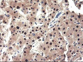 NUBPL Antibody - IHC of paraffin-embedded Human liver tissue using anti-NUBPL mouse monoclonal antibody. (Heat-induced epitope retrieval by 10mM citric buffer, pH6.0, 100C for 10min).