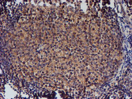NUBPL Antibody - IHC of paraffin-embedded Human tonsil using anti-NUBPL mouse monoclonal antibody. (Heat-induced epitope retrieval by 10mM citric buffer, pH6.0, 100C for 10min).