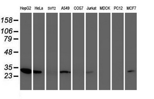 NUBPL Antibody - Western blot of extracts (35ug) from 9 different cell lines by using anti-NUBPL monoclonal antibody.