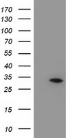NUBPL Antibody - HEK293T cells were transfected with the pCMV6-ENTRY control (Left lane) or pCMV6-ENTRY NUBPL (Right lane) cDNA for 48 hrs and lysed. Equivalent amounts of cell lysates (5 ug per lane) were separated by SDS-PAGE and immunoblotted with anti-NUBPL.