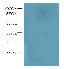 NUBPL Antibody - Western blot. All lanes: NUBPL antibody at 1 ug/ml+ A431 whole cell lysate Goat polyclonal to rabbit at 1:10000 dilution. Predicted band size: 34 kDa. Observed band size: 34 kDa.