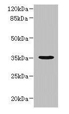 NUBPL Antibody - Western blot All lanes: NUBPL antibody at 1µg/ml + A431 whole cell lysate Secondary Goat polyclonal to rabbit IgG at 1/10000 dilution Predicted band size: 35, 19 kDa Observed band size: 35 kDa