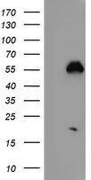 NUCB1 / Nucleobindin Antibody - HEK293T cells were transfected with the pCMV6-ENTRY control (Left lane) or pCMV6-ENTRY NUCB1 (Right lane) cDNA for 48 hrs and lysed. Equivalent amounts of cell lysates (5 ug per lane) were separated by SDS-PAGE and immunoblotted with anti-NUCB1.