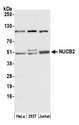 NUCB2 / Nucleobindin 2 Antibody - Detection of human NUCB2 by western blot. Samples: Whole cell lysate (50 µg) from HeLa, HEK293T, and Jurkat cells prepared using NETN lysis buffer. Antibody: Affinity purified rabbit anti-NUCB2 antibody used for WB at 0.1 µg/ml. Detection: Chemiluminescence with an exposure time of 30 seconds.