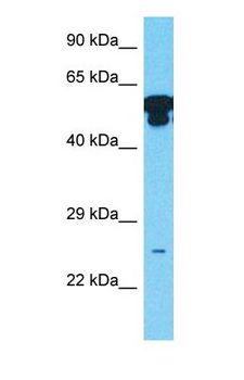 NUCKS1 Antibody - Western blot of NUCKS Antibody with human Stomach Tumor lysate.  This image was taken for the unconjugated form of this product. Other forms have not been tested.