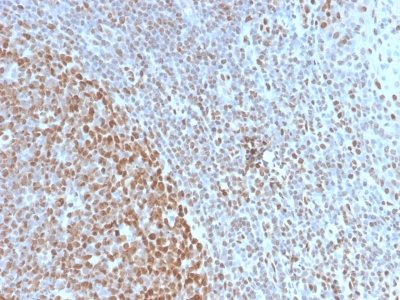 Nuclear Antigen Antibody - Formalin-fixed, paraffin-embedded human Tonsil stained with Pan-Nuclear Antigen Rabbit Recombinant Monoclonal Antibody (NM2984R).