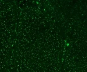 Nuclear Membrane Marker NM97 Antibody - Immunofluorescent testing of colon carcinoma with Alexa Fluor 488 conjugated Nucleoli marker antibody.  This image was taken for the unmodified form of this product. Other forms have not been tested.