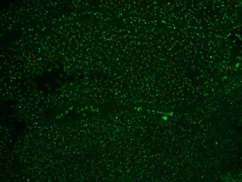 Nuclear Membrane Marker NM97 Antibody - IF testing of colon carcinoma with Alexa Fluor 488 conjugated Nucleoli marker antibody.