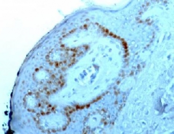 Nuclear Membrane Marker NM97 Antibody - IHC staining of FFPE human skin with Nucleoli marker antibody.  This image was taken for the unmodified form of this product. Other forms have not been tested.