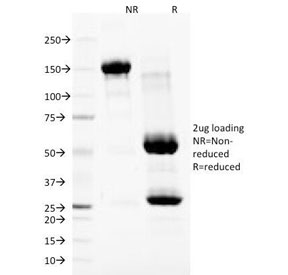 Nuclear Membrane Marker NM97 Antibody - SDS-PAGE Analysis of Purified, BSA-Free Nuclear Membrane Marker Antibody (clone NM97). Confirmation of Integrity and Purity of the Antibody.