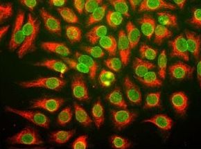 Nuclear Pore Complex Antibody - Immunostaining of HeLa cells with anti-nuclear pore complex antibody (green), and chicken anti-vimentin (red).