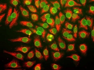 Nuclear Pore Complex Antibody - Immunofluorescent staining using Nuclear Pore Complex antibody. Immunofluorescent staining of HeLa cells with anti-nuclear pore complex antibody (green), and chicken anti-vimentin (red)