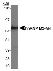 Nuclear Ribonucleoprotein M3/M4 Antibody - hnRNP M3-M4 Antibody - Western blot of hnRNP M3-M4 in HeLa cell lysate.