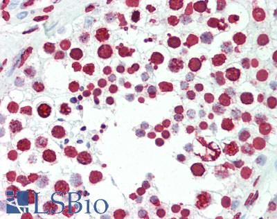 Nuclei and Chromosomes, Histone specific Antibody - Human Testis: Formalin-Fixed, Paraffin-Embedded (FFPE), at a dilution of 1:50.