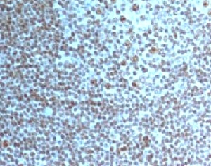 Nucleolar Antigen Antibody - IHC testing of Nucleoli marker antibody and FFPE human tonsil tissue.  This image was taken for the unmodified form of this product. Other forms have not been tested.