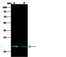 NucleoProtein Antibody - Anti-Ebola virus EBOV (subtype Zaire, strain H.sapiens-wt/GIN/2014/Kissidougou-C15) Nucleoprotein / NP rabbit polyclonal antibody at 1:1000 dilution.Sample:Ebola virus EBOV (subtype Zaire, strain H.sapiens-wt/GIN/2014/Kissidougou-C15) Nucleoprotein / NP Recombinant Protein. Lane A: 50ng. Lane B: 20ng. SecondaryGoat Anti-Rabbit IgG H&L (Dylight 800) at 1/10000 dilution. Developed using the Odyssey technique. Performed under reducing conditions.