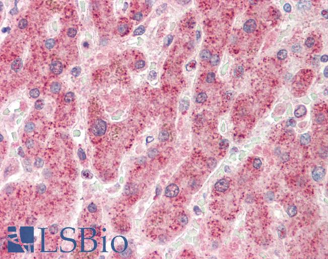 NUDC Antibody - Human, Liver: Formalin-Fixed Paraffin-Embedded (FFPE).  This image was taken for the unconjugated form of this product. Other forms have not been tested.