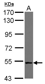 NUDCD1 Antibody - Sample (30 ug of whole cell lysate) A: NT2D1 7.5% SDS PAGE NUDCD1 antibody diluted at 1:10000