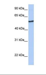 NUDCD1 Antibody - Placenta lysate. Antibody concentration: 1.0 ug/ml. Gel concentration: 12%.  This image was taken for the unconjugated form of this product. Other forms have not been tested.