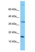 NUDCD2 Antibody - NUDCD2 antibody Western Blot of HepG2. Antibody dilution: 1 ug/ml.  This image was taken for the unconjugated form of this product. Other forms have not been tested.