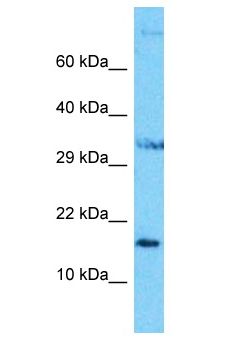 NUDCD2 Antibody - NUDCD2 antibody Western Blot of HepG2. Antibody dilution: 1 ug/ml.  This image was taken for the unconjugated form of this product. Other forms have not been tested.