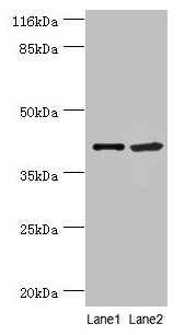 NUDCD3 Antibody - Western blot All lanes: EXOSC5 antibody at 5µg/ml Lane 1: 293T whole cell lysate Lane 2: Hela whole cell lysate Lane 3: Hela whole cell lysate Secondary Goat polyclonal to rabbit IgG at 1/10000 dilution Predicted band size: 41 kDa Observed band size: 41 kDa